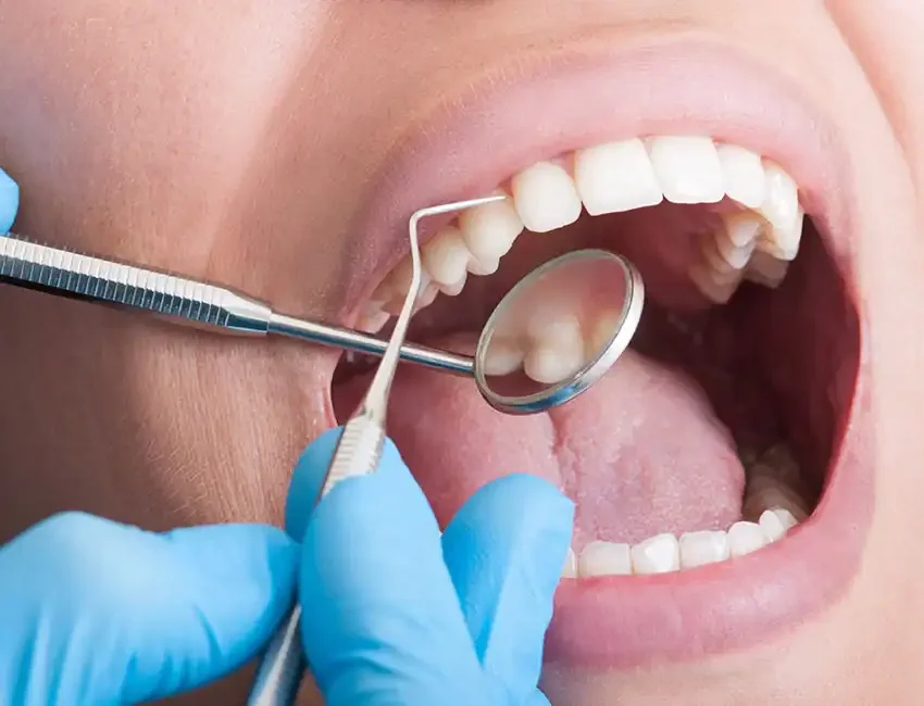 Patinet getting dental checkup