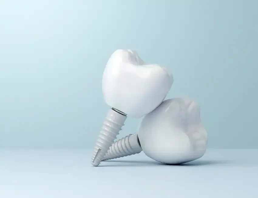 Single Tooth Implant in Foothill Ranch